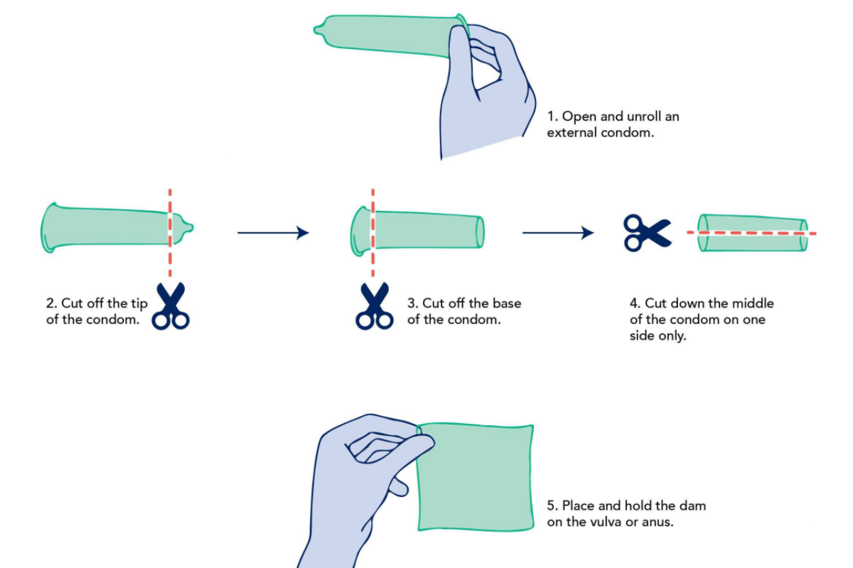 DIY Dental Dam Instructions