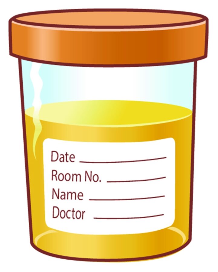 Image of urine sample